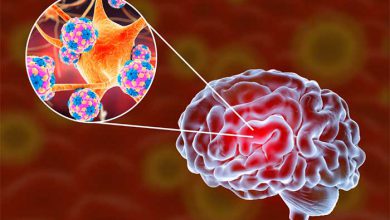 بیماری زمان تزریق واکسن مننژیت+ مراقبت بعد از واکسن مننژیت